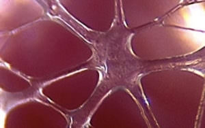 microarchifascia