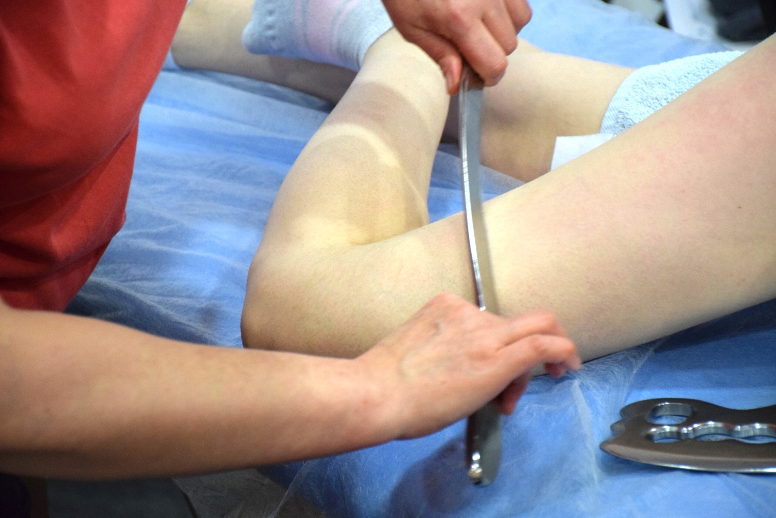 Инструментальная мобилизация мягких тканей (IASTM) Школа «Реабилитолог» 34558