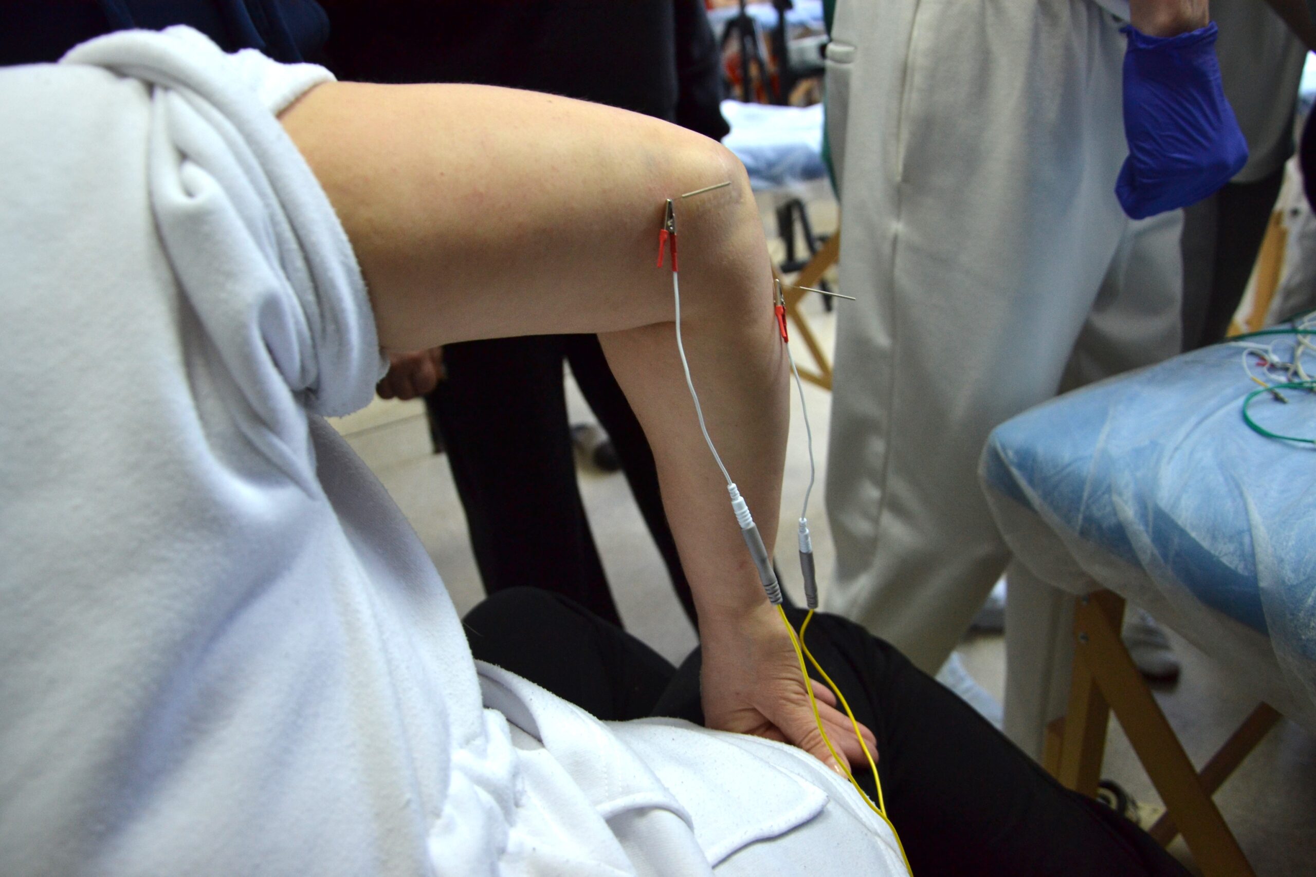 Застосування методу сухої голки (dry needling) у реабілітації Школа «Реабілітолог» 31580