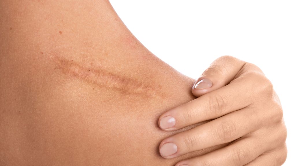 Применение остеопатических принципов в лечении рубцов Школа «Реабилитолог» 36425